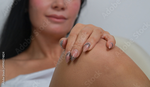 Hand hält schmerzendes Knie – Arthrose, Gelenkschmerzen, Entzündung, Medizin, Gesundheit, Therapie, Rehabilitation, Körper, Nahaufnahme, Copyspace, isoliert