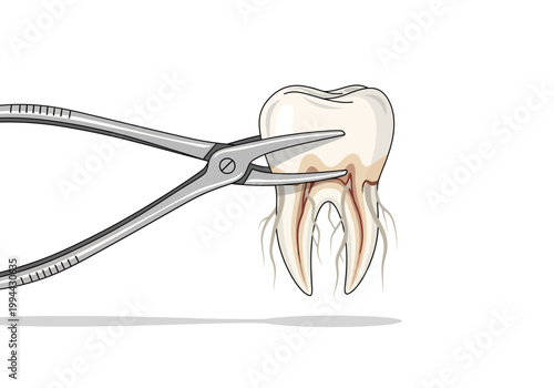 Dentist uses forceps to extract a tooth with visible roots.