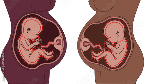 Human fetus development inside pregnant woman womb anatomy medical illustration showing baby growth stages vector isolated