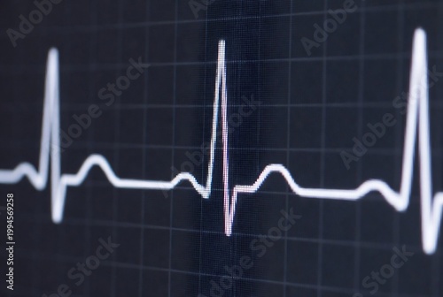 An electrocardiogram (ECG) displaying a heart rhythm on a grid background.