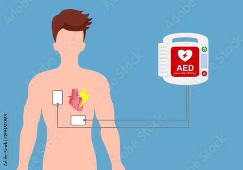 Image illustration of lifesaving measures with an automatic external defibrillator