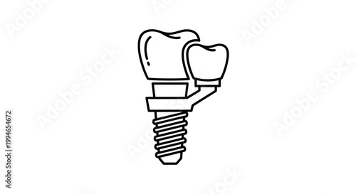 Dental Implant with Crown - Medical Icon