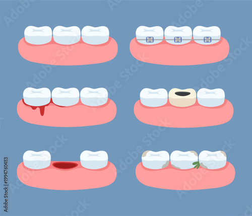 Set of icons illustrating dental problems, braces, gum bleeding, oral hygiene, tooth decay, tooth extraction, and whitening. Concept of dental care