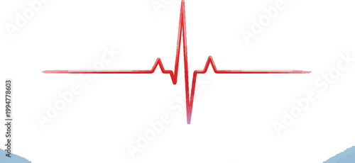 Electrocardiogram waveform displaying a normal heartbeat rhythm pattern