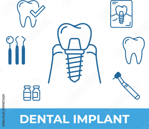 Minimalist vector illustration featuring a dental implant core design surrounded by various essential professional medical instruments and clinical oral icons