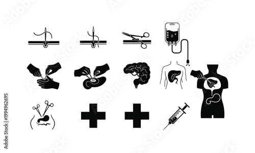 Medical procedures and surgery icons set
