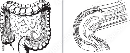 Human digestive system anatomy with large and small intestines detailed in a scientific line drawing illustration isolated on white background