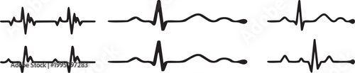 ECG Waveform Analysis: Detailed representation of the electrical activity of the heart. These dynamic waveforms offer a visual representation of heart function.