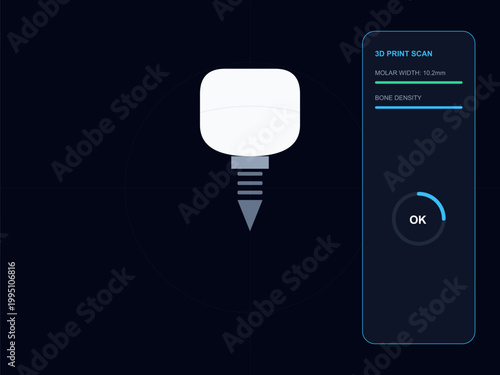 Smart Dental Implant Technology with 3D Molar Crown and Titanium Screw Analysis