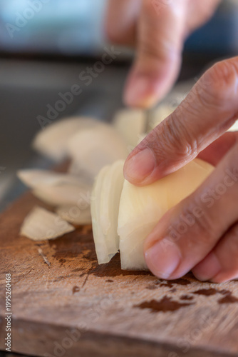 Close-up of Senior Woman Hands Slicing White Onion on Wooden Cutting Board