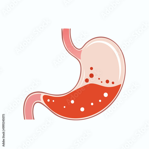 Anatomical illustration depicting the human stomach, highlighting issues related to acid reflux, indigestion, and overall digestive system health concerns