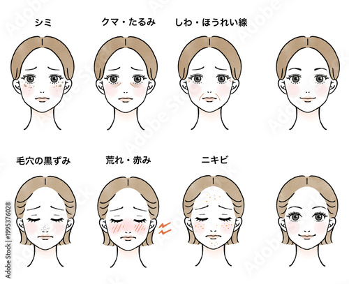 Fotografía 肌年齢、肌トラブルに悩む女性の顔のイラストセット