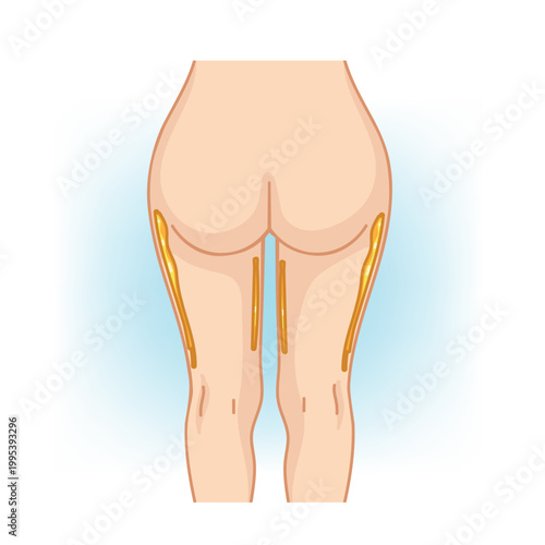 Slim and Well-Proportioned Thighs