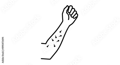 Illustration of an arm undergoing a skin allergy test with marked injection sites, minimalistic black line art on white background