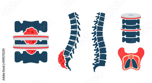 Spine Anatomy, Disc Herniation, Spinal Cord Injury, Vertebrae Health