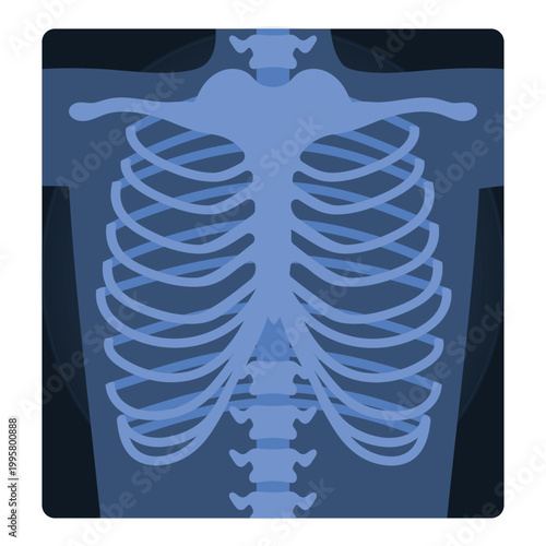 Medical xray scan of human chest. Medical skeleton test, body radiography cartoon vector illustration