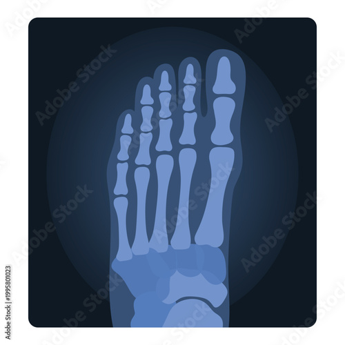 Xray shot of human foot. Medical skeleton test, body radiography cartoon vector illustration