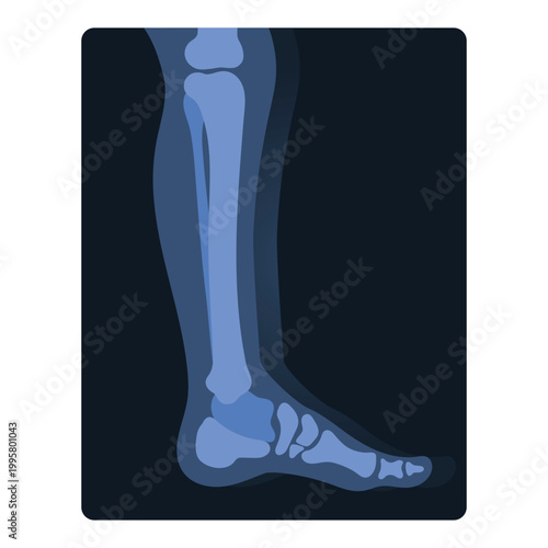 Xray shot of human leg. Medical skeleton test, body radiography cartoon vector illustration