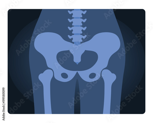 Xray shot of human pelvis. Medical skeleton test, body radiography cartoon vector illustration