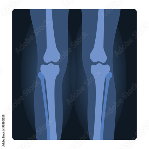 Xray shot of human knees. Medical injury test, body radiography cartoon vector illustration
