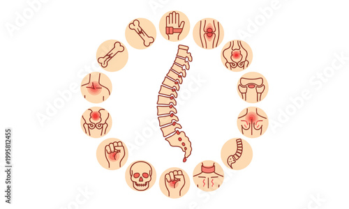 Human Spine Anatomy with Bone and Joint Pain Icons
