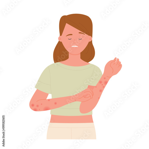 Girl scratching hands covered with red rash. Skin allergic reaction, atopic dermatitis vector flat illustration