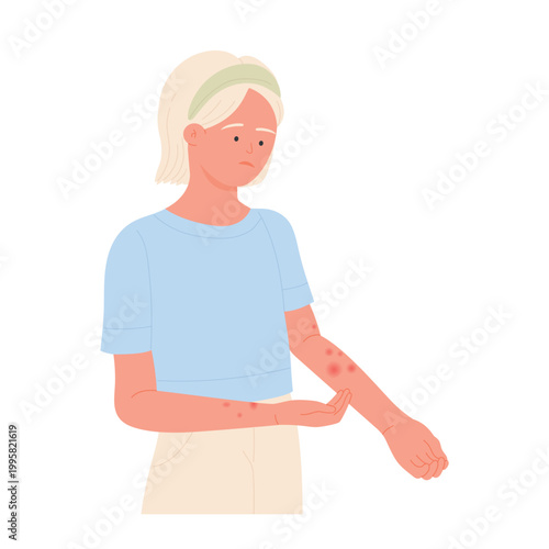 Sad girl with allergy reaction on hands. Itchy skin, red rash on hands, atopic dermatitis vector flat illustration