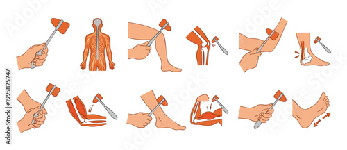 Reflex hammer medical examination set showing neurological testing of knee, elbow, and ankle joints for clinical diagnosis. Human body nervous system anatomy chart illustrating doctor patient physical