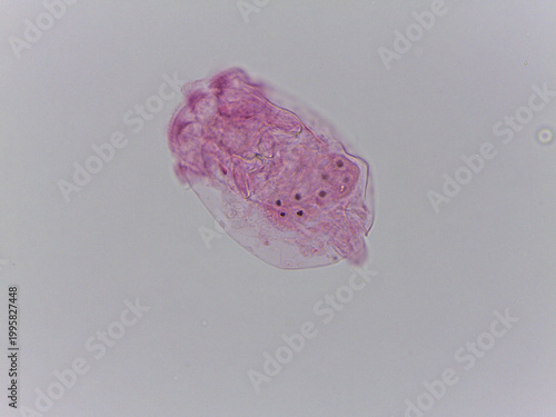 Foto Brachionus Rotifer Multiple Specimens Lorica Morphology Light Micros