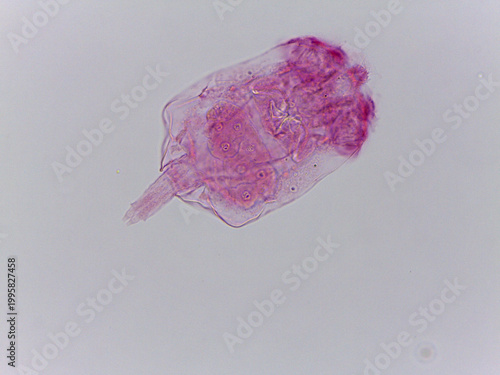 Quadro su tela Brachionus Rotifer Multiple Specimens Lorica Morphology Light Micros