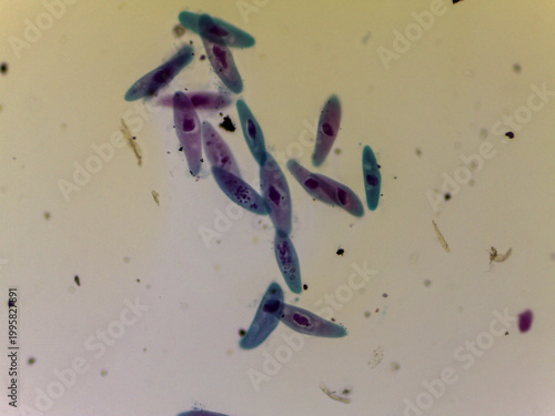 фотографія Paramecium Multimicronucleatum Multiple Individuals Dense Population Light Micro