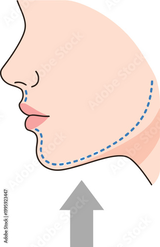 Cosmetic Surgery Illustration: An illustration depicts a profile view of a face, with dotted lines suggesting cosmetic enhancements and an upward arrow indicating progress. 