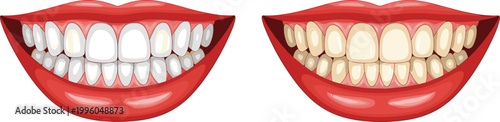 Healthy vs. Yellow Teeth Comparison with Whitening and Stained Teeth Illustration