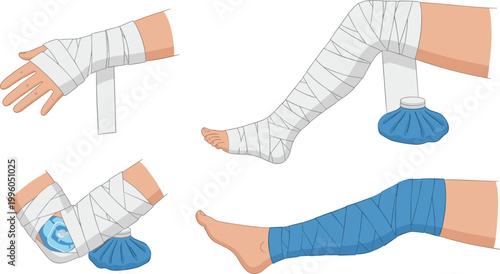 
Medical bandage wrapping on hand ankle and leg with ice pack for injury treatment and first aid healthcare vector illustration set