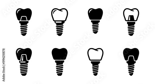 Dental implant icons set with 8 vector elements, black and white tooth prosthetics symbols, stomatology surgery and restorative dentistry graphics
