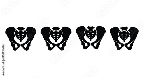 Four anatomical pelvis illustrations depicted as a striking black silhouette