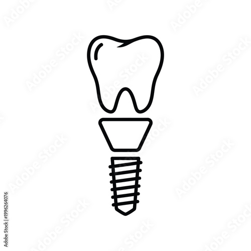 Black line of a dental implant with tooth line black
