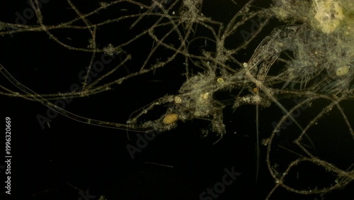 Konstfotografi Filamentous cyanobacteria mat with detritus in darkfield at 10x