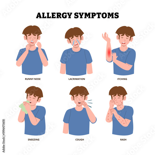 Allergy symptoms poster design with man runny nose, lacrimation, itching skin, sneezing, cough, rash skin. Medical science educational illustration. Hypersensitivity reaction immune system response.