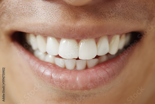 男性の白く健康的な歯のクローズアップ（審美歯科・ホワイトニング）｜Close-up of healthy white teeth of a Japanese man