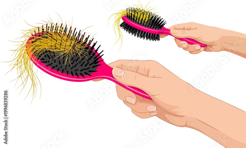 Hair loss concept vector illustration, hand holding pink hairbrush with tangled blonde strands, alopecia and thinning hair medical infographic