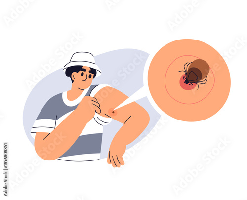Checking skin for tick bites. Man finding red mark and bloodsucker, encephalitis insect on arm. Redness spot and parasite, infectious pest. Flat vector illustration isolated on white background