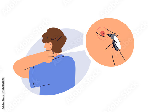 Man scratching itchy neck after mosquito bite. Itch skin reaction, irritation, redness, inflammation, red mark after bloodsucker insect. Flat vector illustration isolated on white background