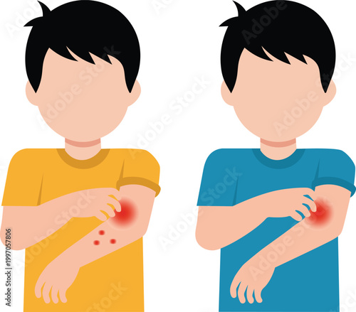 Child Scratching Arm. Includes Allergy, Skin, Rash, Itchy, Dermatitis, Pediatric, Healthcare, and Medical. Professional Flat Vector Illustration.