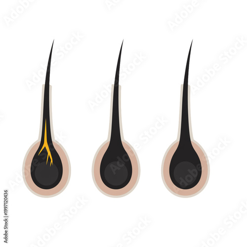 Human hair follicle anatomy vector illustration, skin scalp cell structure, medical dermatology hair growth health diagram