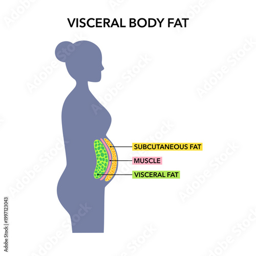 Visceral fat in a female body in flat design on white background. Woman with a big belly and subcutaneous visceral fat inside.