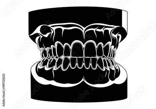 Stylized black and white illustration of human teeth in a dental mold