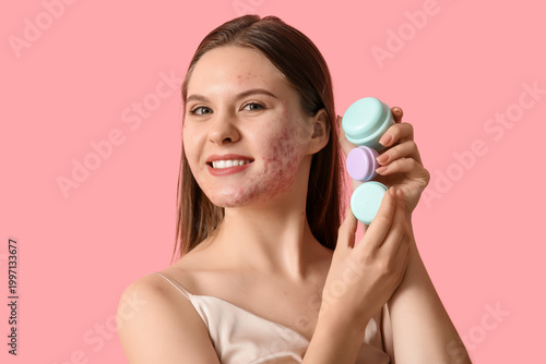 Young woman with acne probl...