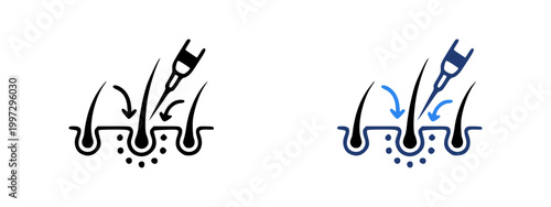 Hair transplant icon set. Hair implant, follicle implantation, baldness treatment, cosmetic surgery, dermatology symbol for medical apps, clinics, healthcare platforms and services - stock vector