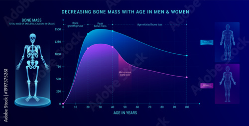 Decreasing bone mass with age in men women. Scientific medical diagram shows information on bone health mass and loss due to menopausal. Joint pain at various ages. Vector.